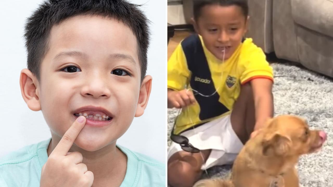 Perrito le ayuda a niño a sacarse el diente de leche y TikTok no para de reír: video se viraliza