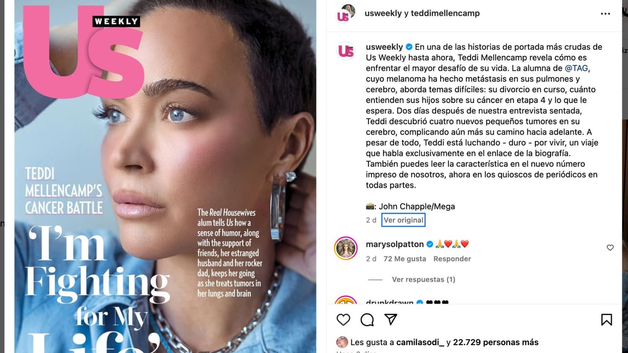 Teddi Mellencamp revela que le detectaron cuatro tumores más.