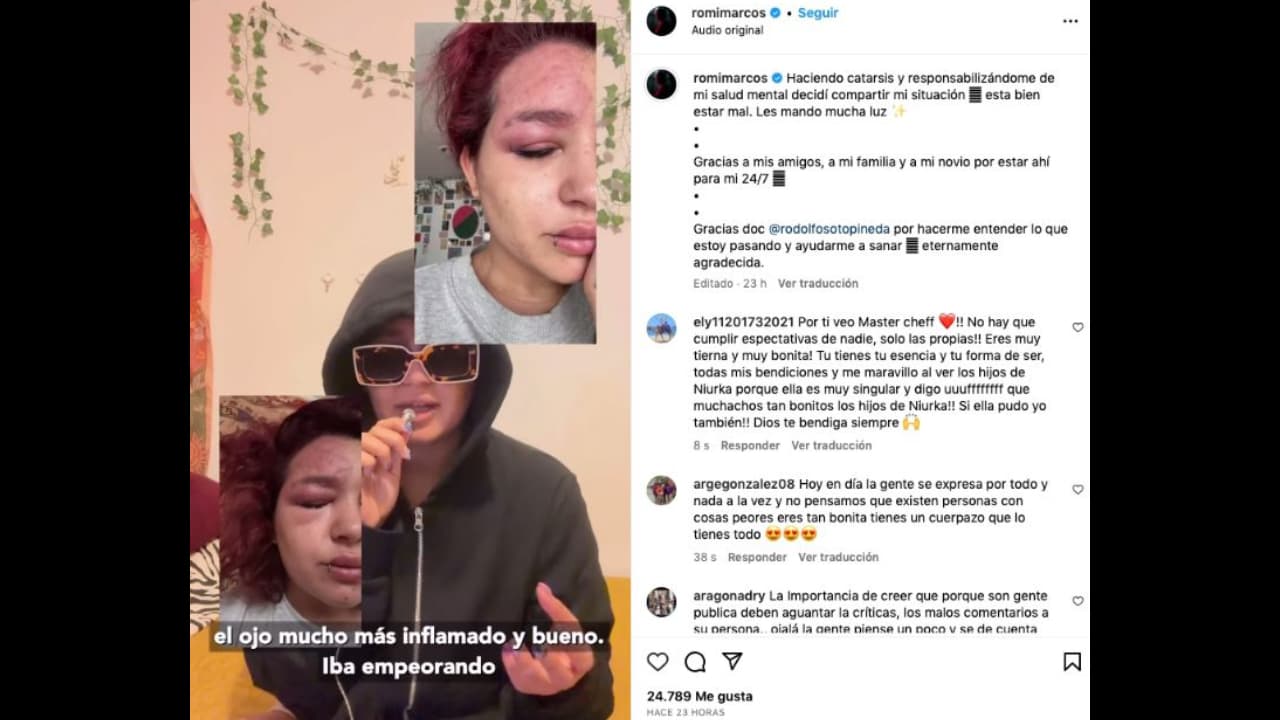 La hija de Niurka se conmovió hasta la lágrimas al revelar lo que padece