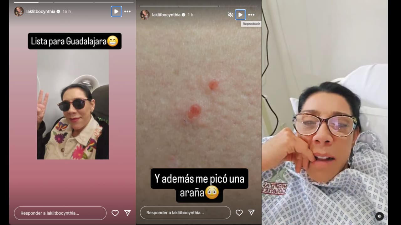 Cynthia Klitbo fue hospitalizada después de ser mordida por una araña tras concluir la grabación de una película en Guadalajara