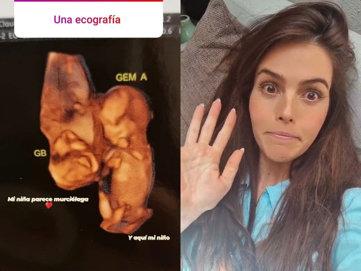 Claudia Álvarez confirma el sexo de sus mellizos y los muestra por primera vez en ultrasonido.