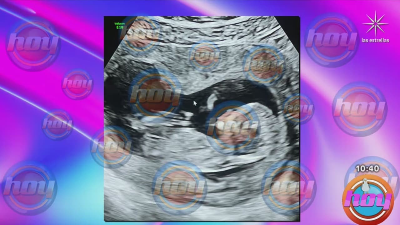 Paul Stanley anunció en Hoy el embarazo de su esposa Joely.