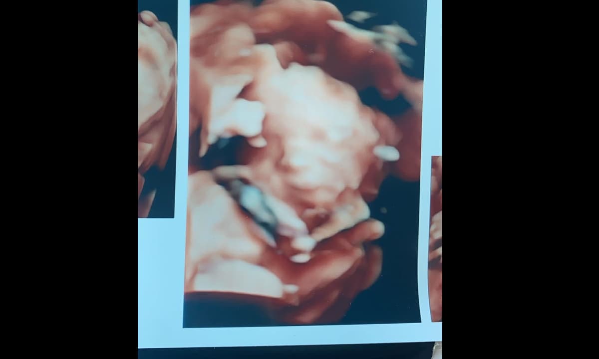 Pedro Prieto presumió la foto de su bebé en redes sociales