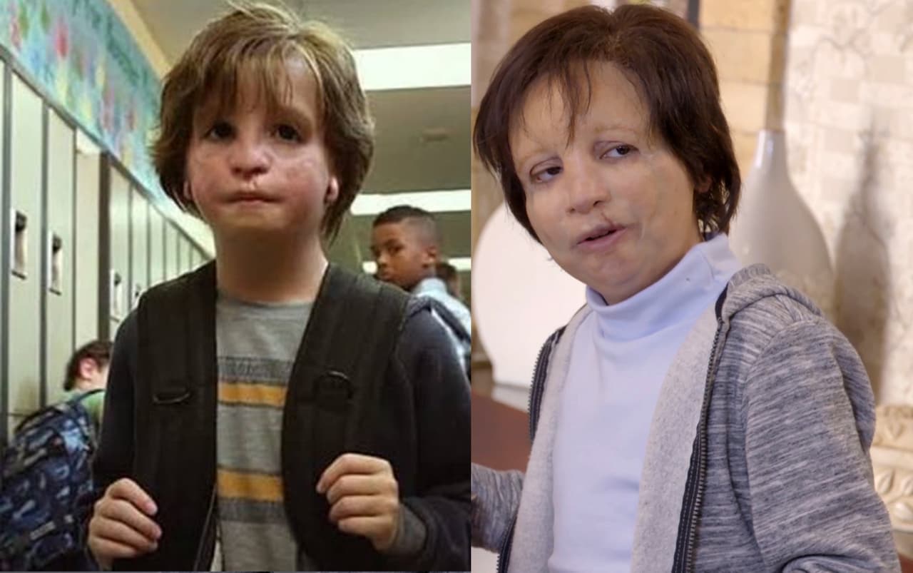 Comparan capítulo de La Rosa de Guadalupe con la película Wonder y lidera la audiencia