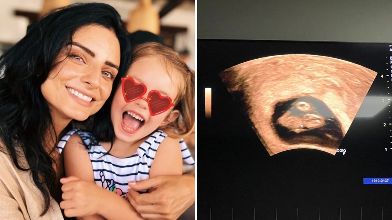 Familia de Aislinn Derbez crece con la llegada de un nuevo bebé: así anuncian inesperado embarazo