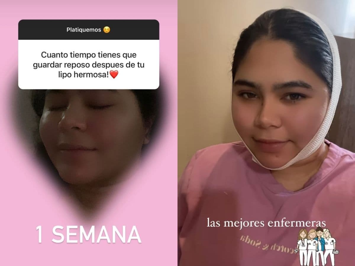 Juliana Figueroa se sometió a tres liposucciones.