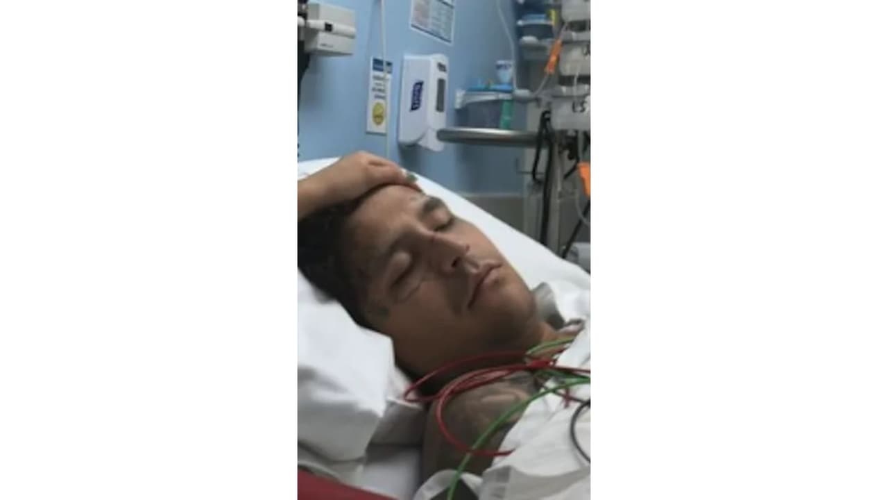 Nodal hospitalízalo.