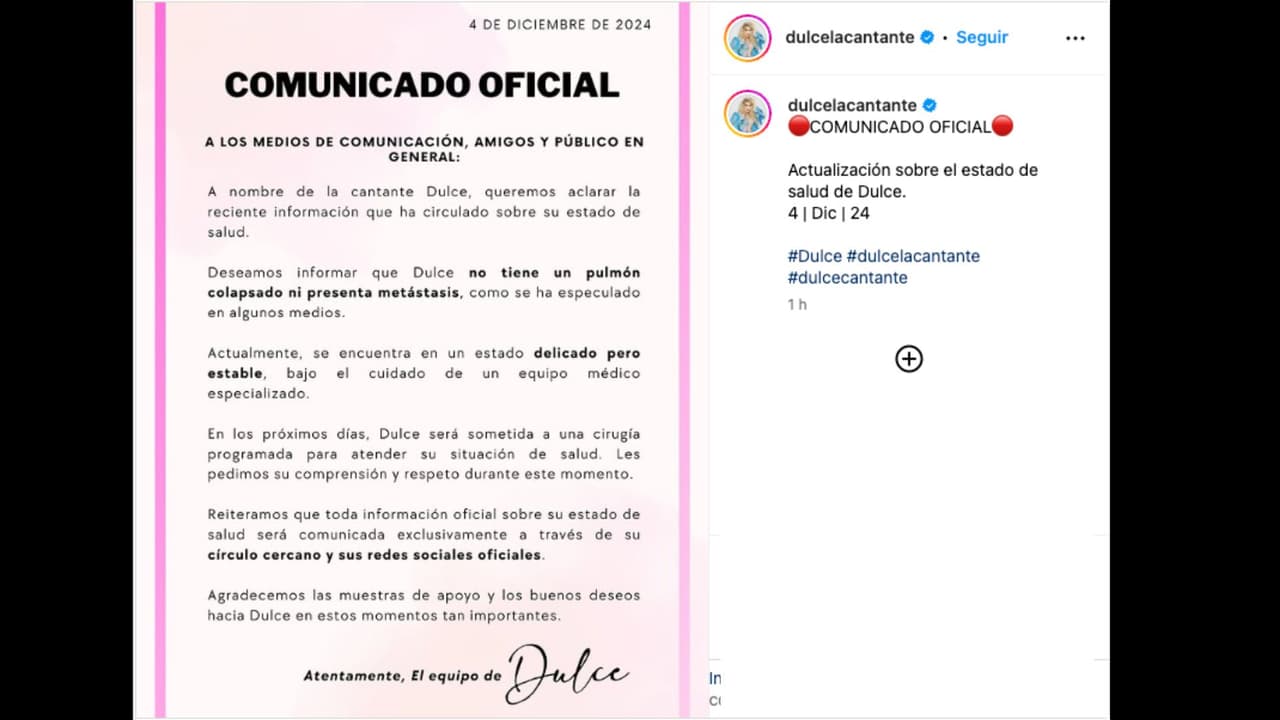 Equipo de Dulce lanza nuevo comunicado sobre su estado de salud de la cantante