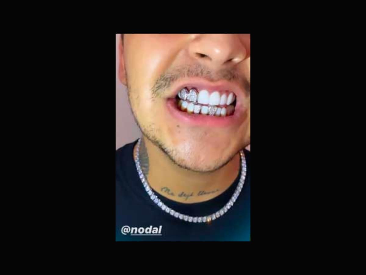 Christian Nodal presumía carillas de oro blanco y diamantes.