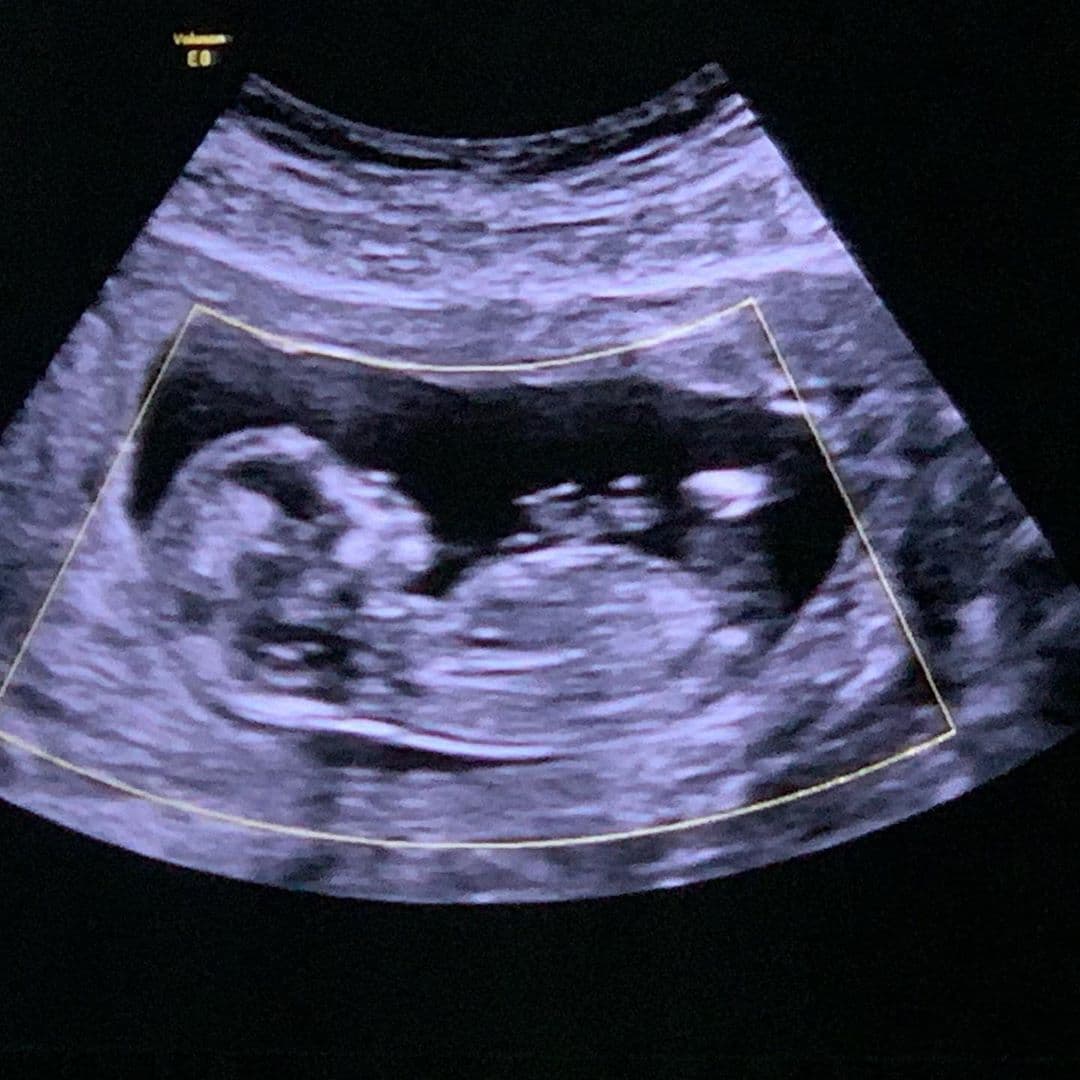 Ari Borovoy y Arlett Kalach se convertirán en padres por cuarta ocasión.