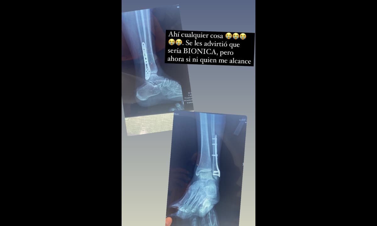 La actriz mostró cómo quedó tras la cirugía