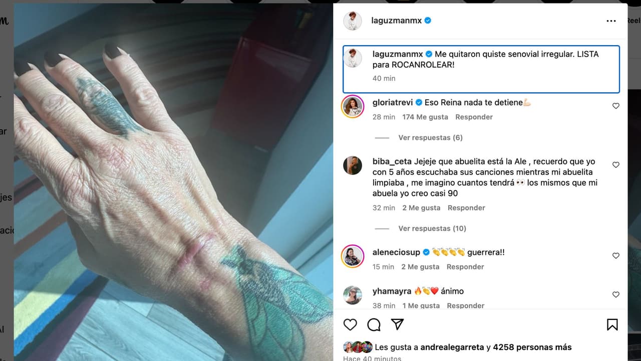 Alejandra Guzmán reaparece tras cirugía.