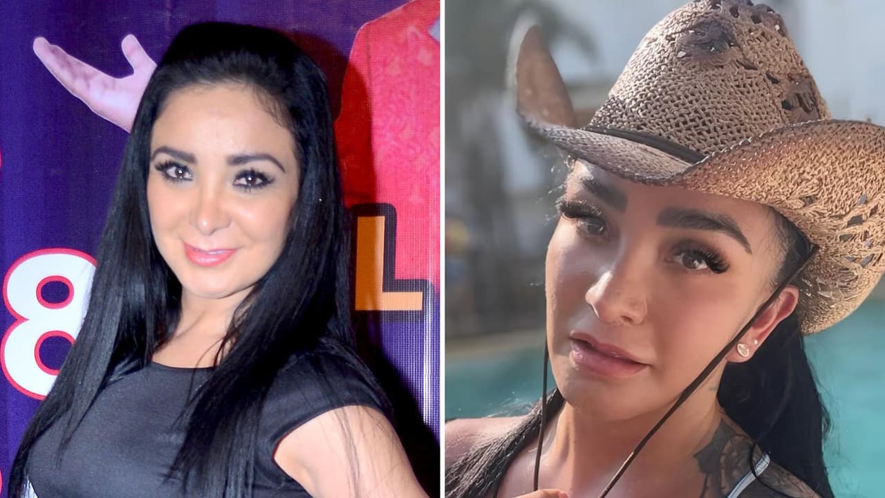 La Wanders Lover sufre tras amputación de parte de su cuerpo: nuevamente es operada de emergencia