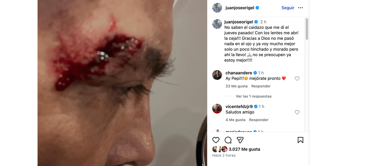 Querido conductor de Televisa y exintegrante de Hoy sufre fuerte caída; publican alarmante foto, revelan su actual estado