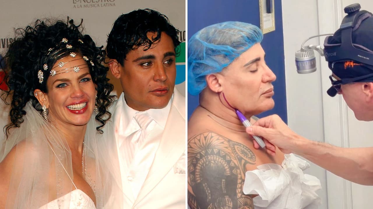 Ex de Niurka se sentía “inseguro” antes de su cirugía estética facial: hoy está en terapia intensiva