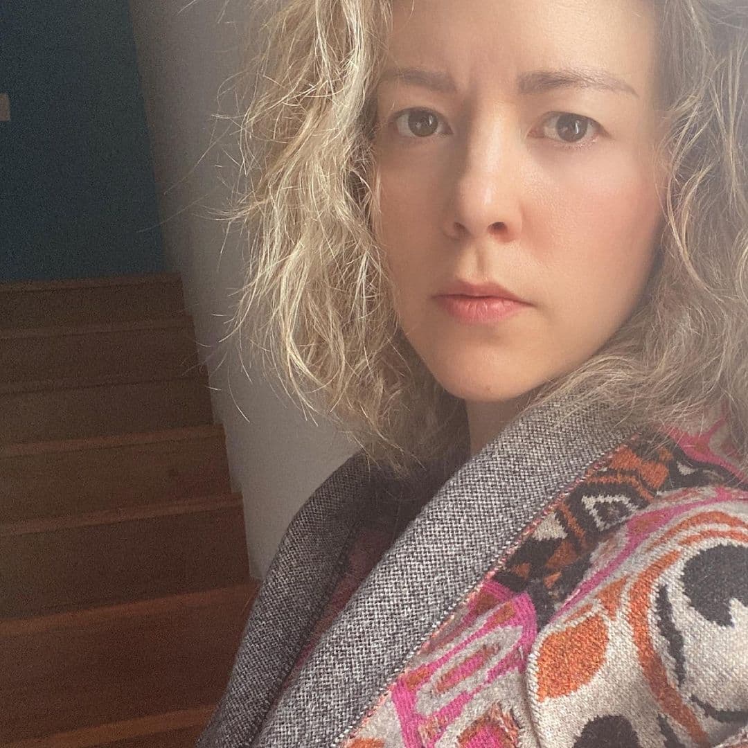 Fernanda Castillo transforma su cara con fuertes tratamientos tras pegarse la piel del vientre