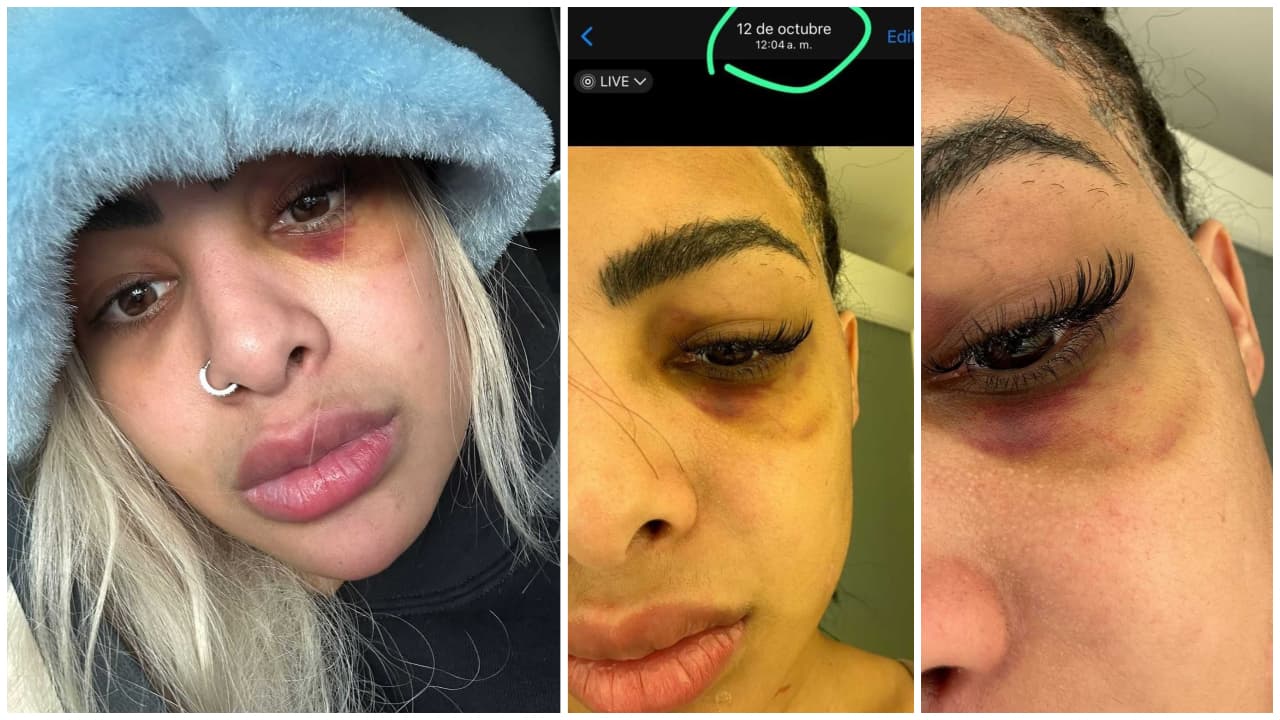 Imágenes de Yailin golpeada difundidas por Santiago Matías Alofoke