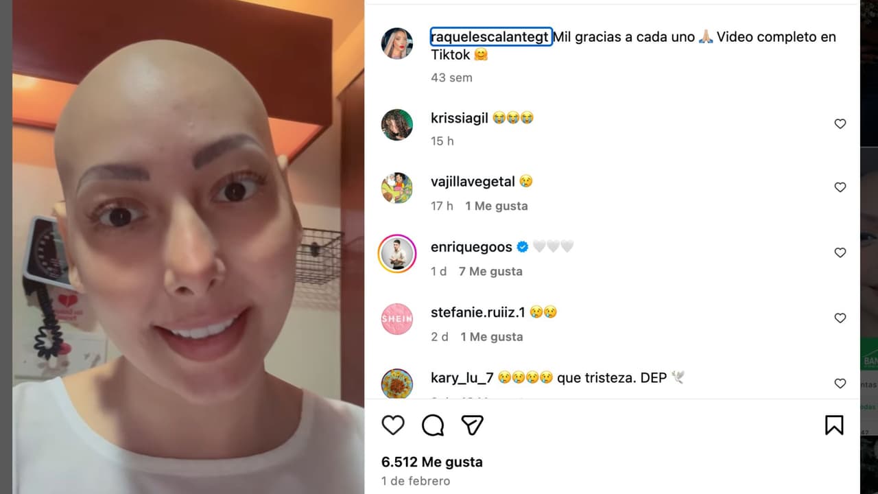 Raquel Escalante habló de su lucha contra el cáncer en redes sociales.