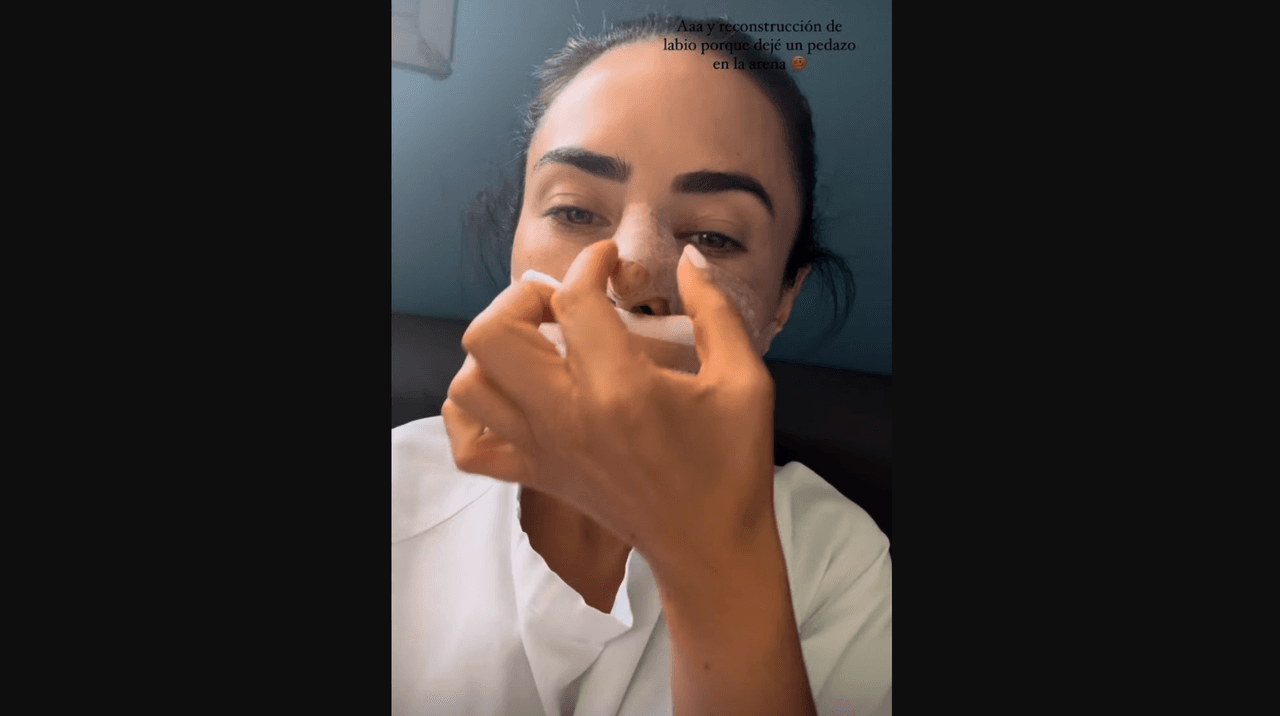 Actriz de telenovelas revela por qué fue sometida a cirugía