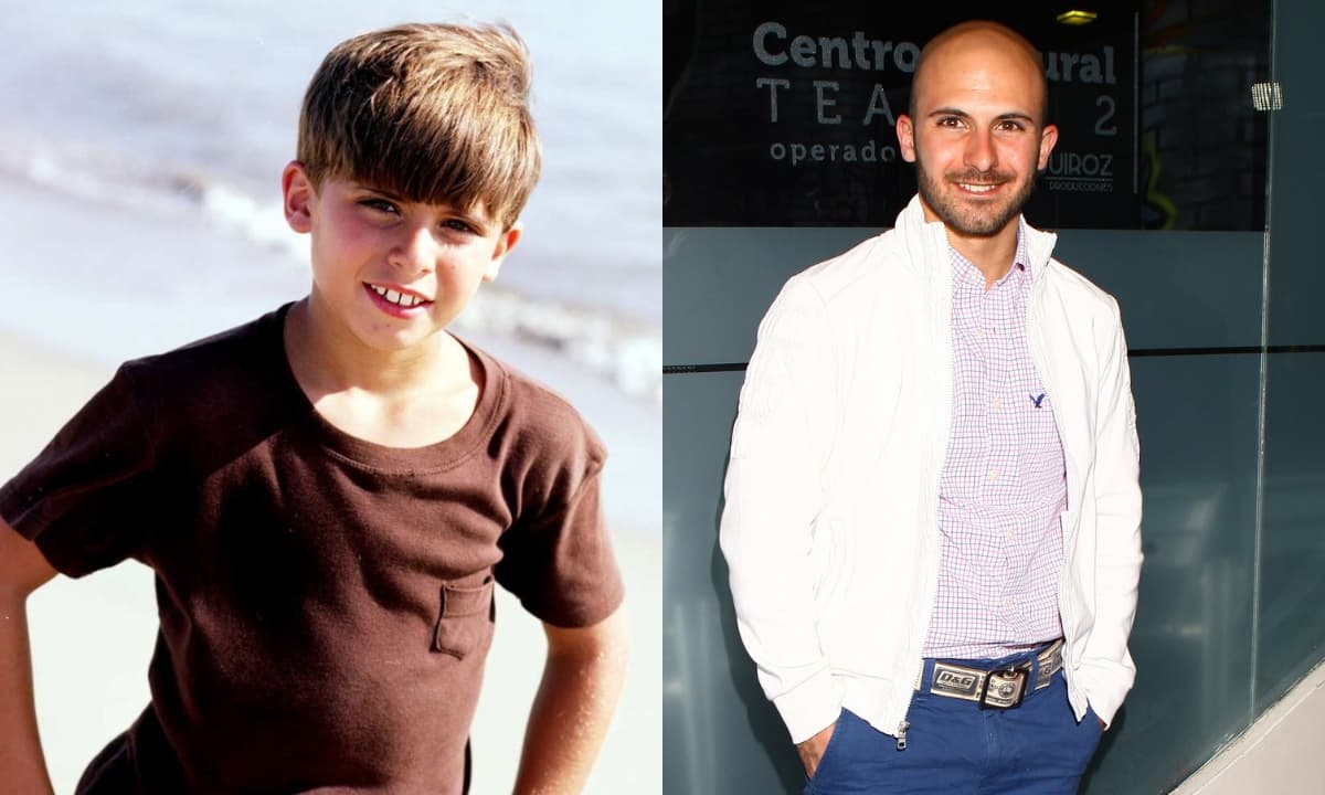 Imanol conmueve al destapar que se quedó calvo a los 14 años: ‘Me agarraba y se me caía el cabello’