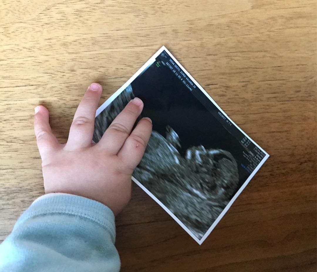 A inicios de noviembre, Zuria Vega anunció con esta foto que estaba embarazada por segunda vez.