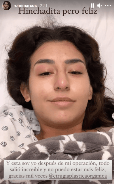 Finalmente, la tarde del pasado miércoles 17 de febrero, Marcos se sometió a tan esperada operación. “Es hoy, es hoy… Lo que va ocurrir el día de hoy es que por fin me voy quitar los implantes. Estoy aquí en Cirugía Plástica Orgánica con el doctor Ricardo, no me puedo sentir más lista y confiada, en las mejores manos para esta operación”, dijo a través de sus redes sociales.