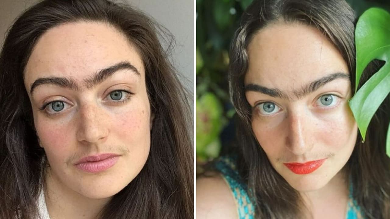 Eldina Jaganjac, la mujer que se niega a afeitarse su bigote y uniceja: ahora tiene más confianza