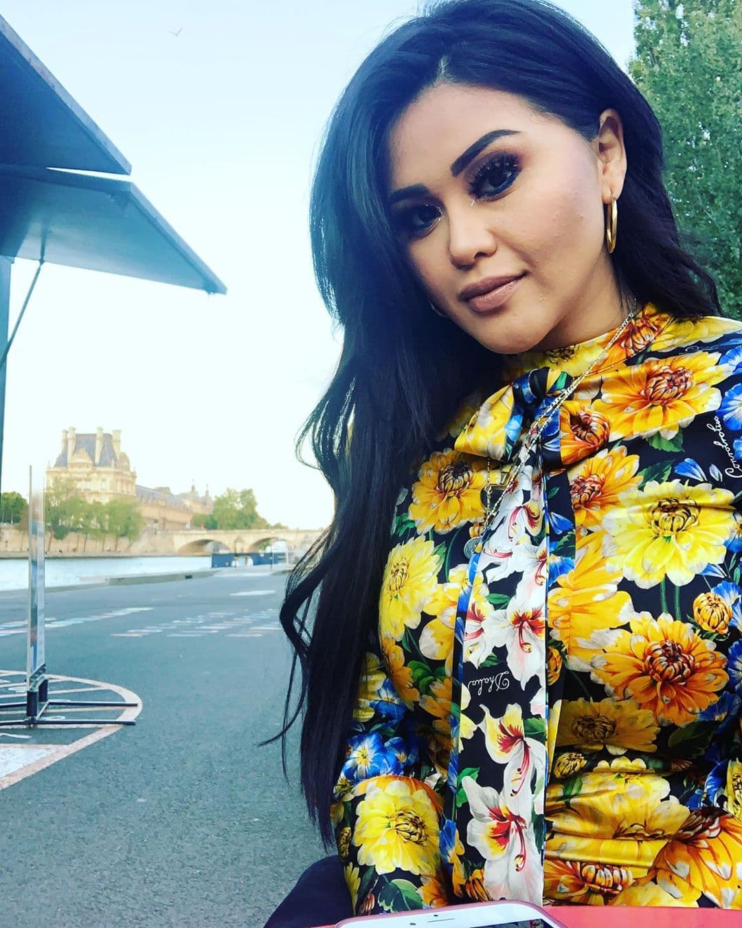 Gomita confiesa por qué se sometió a cirugías plásticas y afirma: ‘Se me hizo vicio’