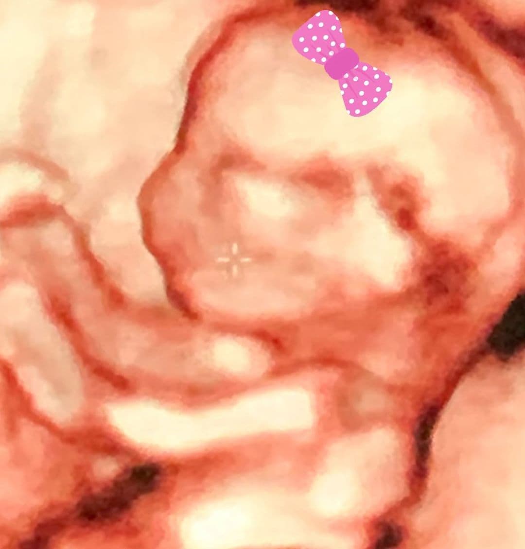 El nacimiento de la pequeña Carlota podría ocurrir en cualquier momento, pues Magda Bleizeffer ya cumplió las 40 semanas de gestación, tal como lo puntualizó en redes sociales hace unas horas.