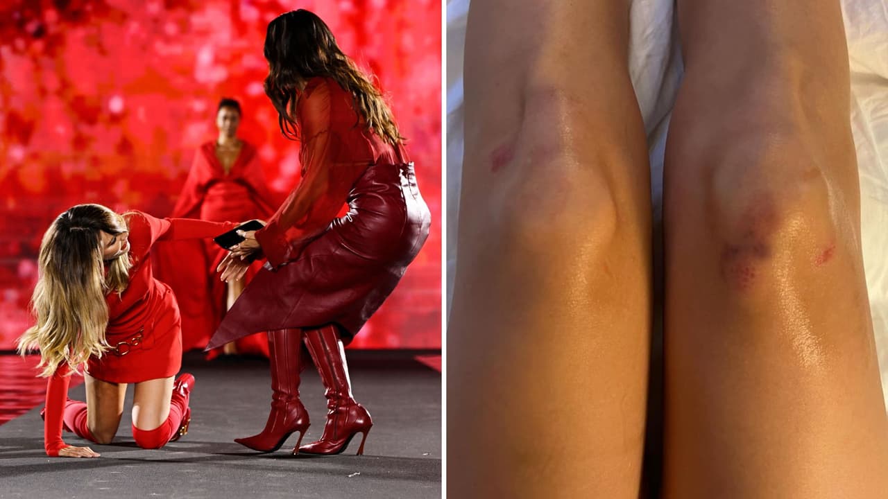 Belinda muestra heridas tras su caída.