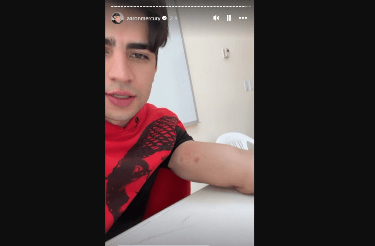 Aarón Mercury sufre lesiones tras bailar en Hoy: preocupa al mostrar lo que le pasó y hace fuerte confesión