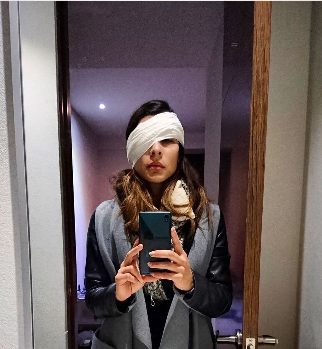 María León impacta a fans por mostrarse en foto con el rostro vendado