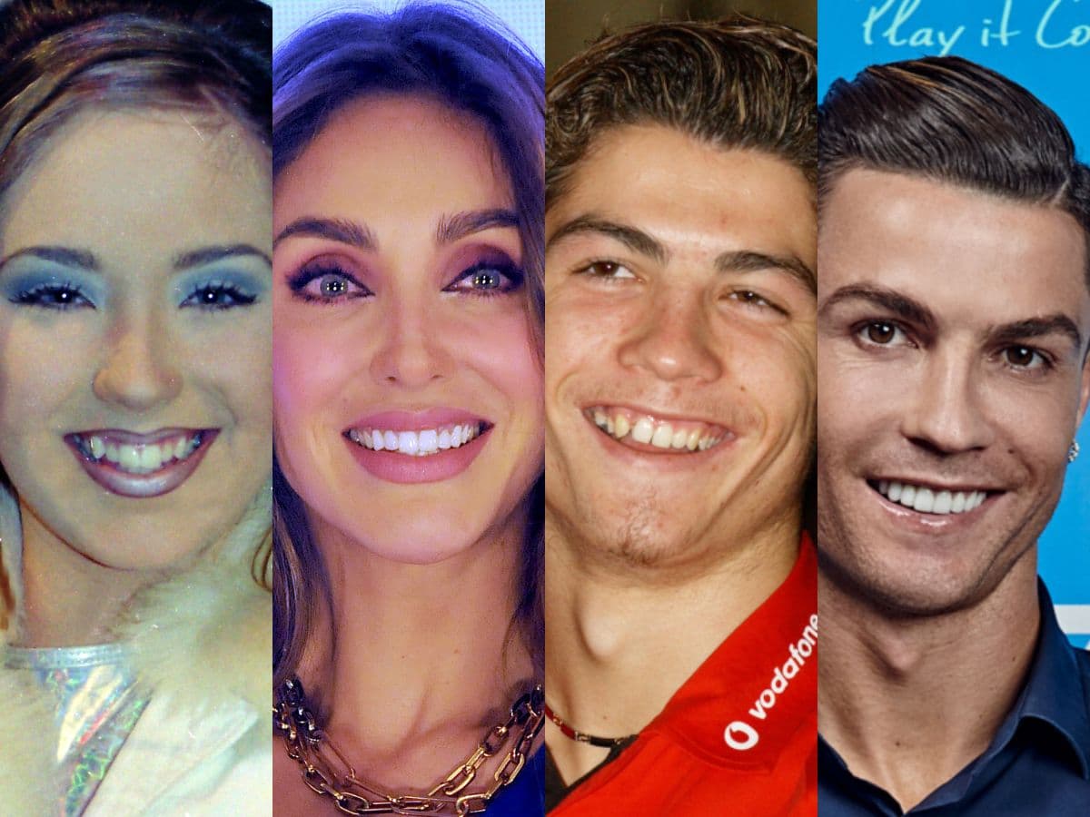 Famosos que se arreglaron los dientes y sorprendieron con su nueva sonrisa