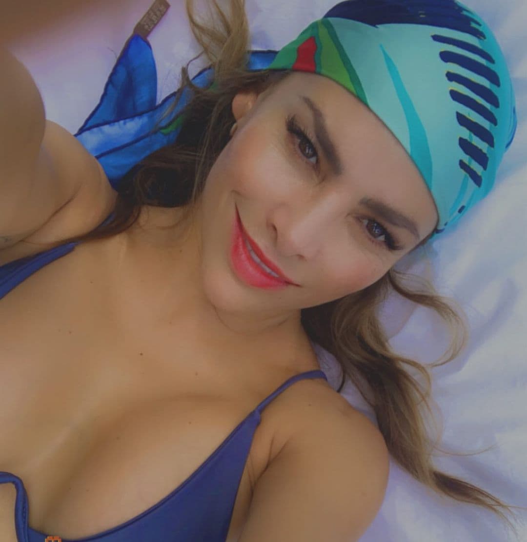 Fabiola Campomanes muestra lesiones en su rostro tras obsesionarse con los tratamientos estéticos