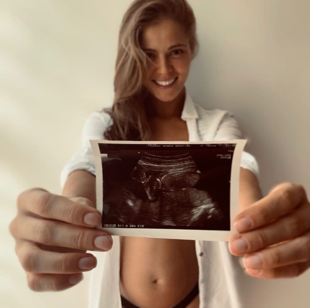 El 23 de junio fue el día en que por primera vez Thuany Martins mostró un ultrasonido de su bebé, imagen que de inmediato se viralizó en redes sociales.