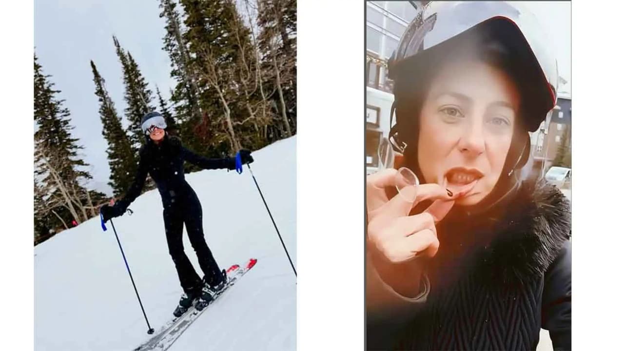 Paulina Mercado comparte el pequeño accidente que sufrió durante sus vacaciones