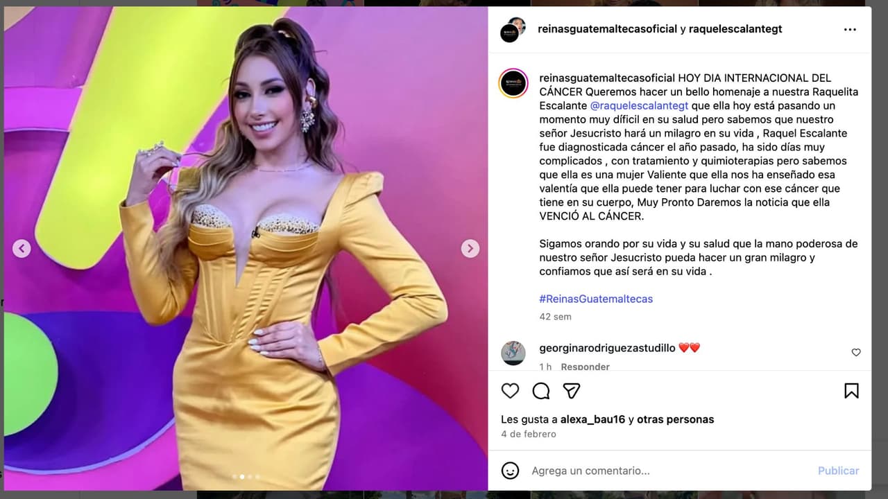 Raquel Escalante luchó contra el cáncer.