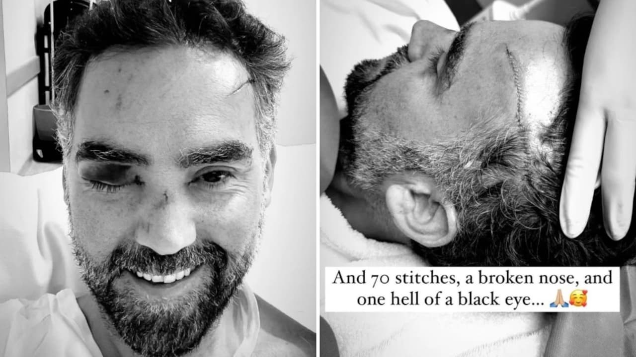 Enrique Acevedo, periodista y conductor de Televisa, sufre aparatoso accidente.