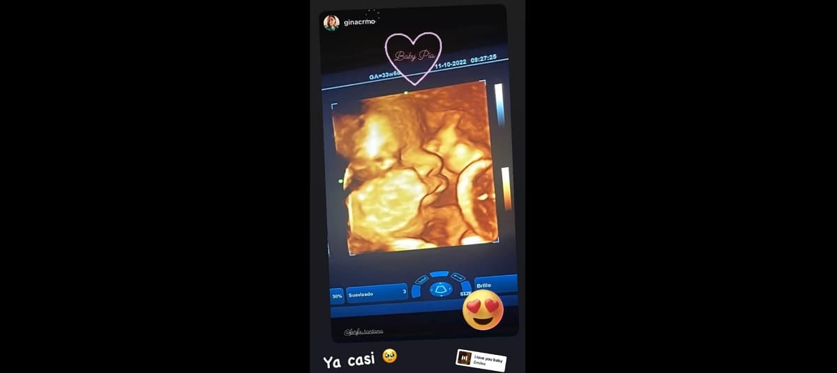 Fernando Santana conmovió con la imagen de su hija Pía