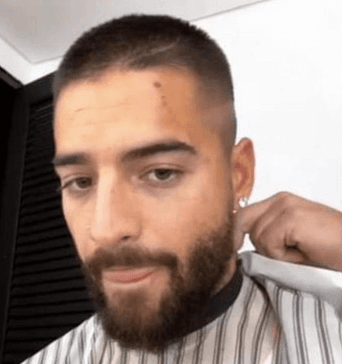 Maluma es atacado por su mascota; muestra la lesión.
