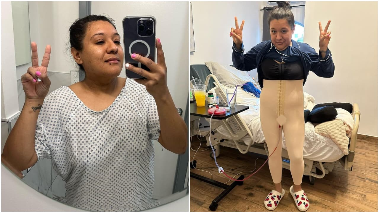 Noemí Valdivia después de su cirugía estética.