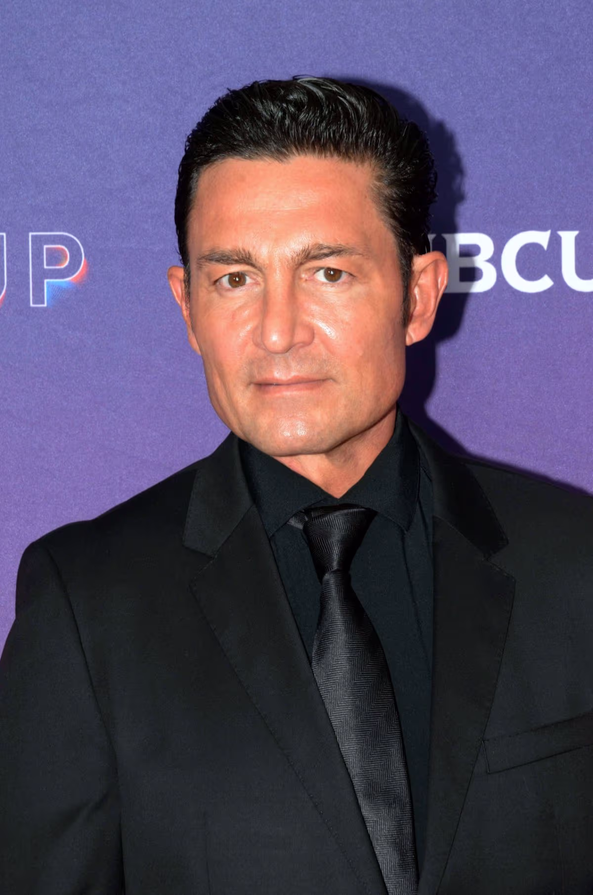 Fernando Colunga aparece con el rostro transformado, ¿qué le pasó ...
