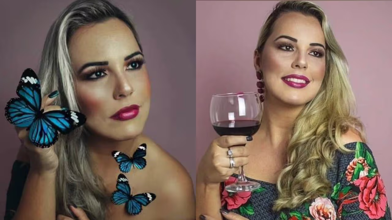 Influencer de 35 años queda sin labios tras tratamiento estético ...